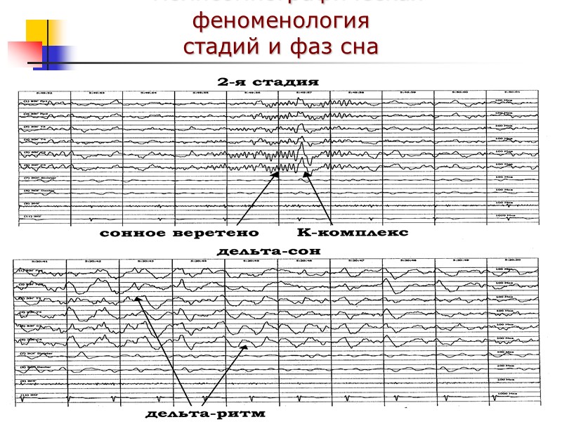 Полисомнографическая феноменология стадий и фаз сна
